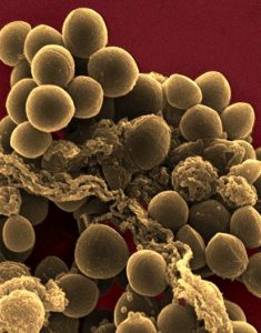 staphylocoques