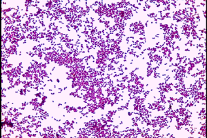 Gram-stained-Enteroccoci-by-Gram-stain-Enteroccoci-appear-as-Gram-positive-diplococci